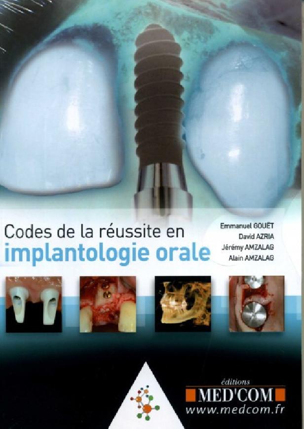 Codes de la réussite en implantologie orale