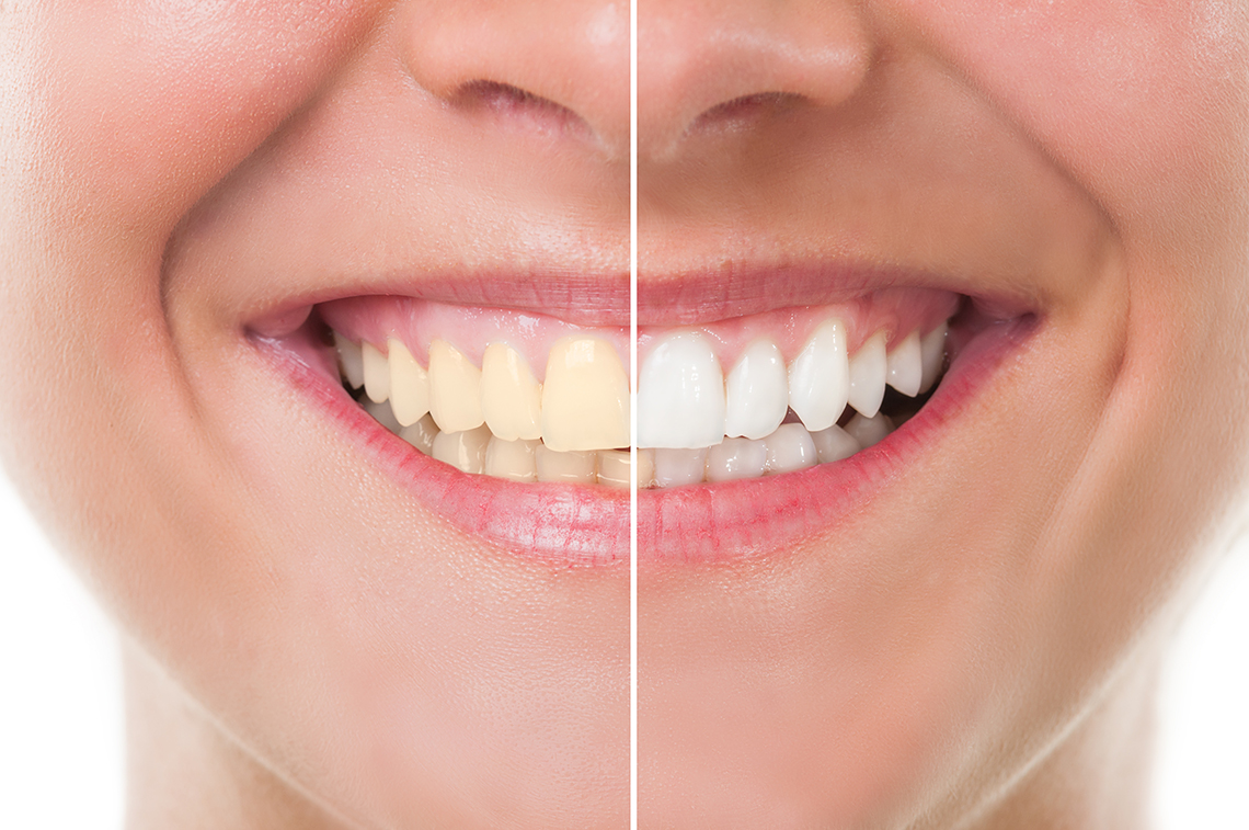 Dents blanches - Cabinet AMZALAG